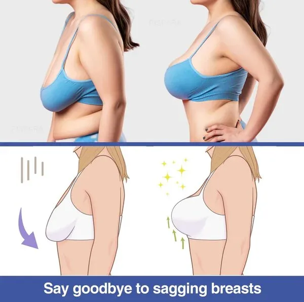 Ice Silk Ion Fiber Restoration Shaping Bra - Skin-friendly Ice Silk Lifting Bra Stretchy Breathable Ultra Thin Ice Silk Bra
